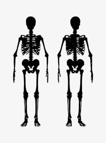 Human Skeleton Silhouette Shape : Stock Vector (Royalty Free) 021513